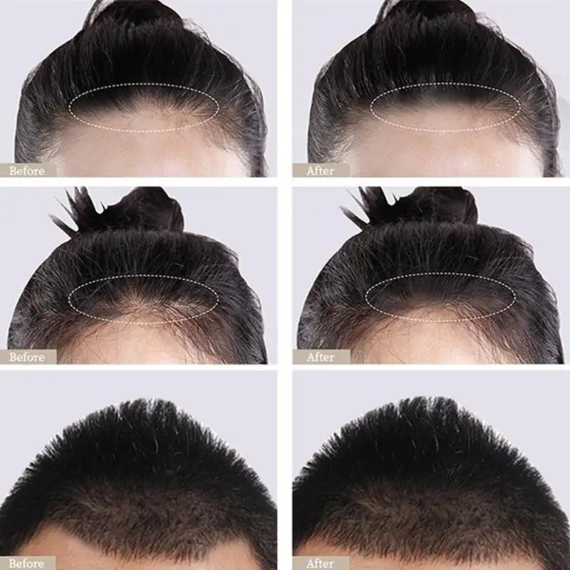Sevich 8G Waterproof Hair Shadow Powder 4 Цвята Hair Root Cover Up Concealer Repair Fill In the Edge Control Hair Line Powder